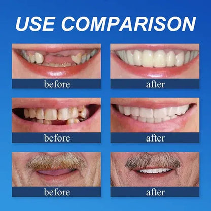 🌎Ends Today: 70% OFF! ⏰LUMIVO® Medical Full Denture with Strong Suctiond🦷Obtain American Dental Association (ADA) Certification