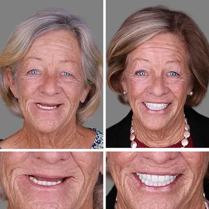 🌎Ends Today: 70% OFF! ⏰LUMIVO® Medical Full Denture with Strong Suctiond🦷Obtain American Dental Association (ADA) Certification